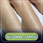 مرکز ‏لیزر ‏و ‏لاغری ‏دلوین ‏خدمات ‏دستگاه ‏لاغری ‏لیزر‏ ‏ازگل