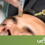 کلینیک زیبایی به آفرین لیزر موهای زاِِئد و تزریق ژل و بوتاکس در سعادت آباد