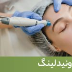 کلینیک زیبایی به آفرین لیزر موهای زاِِئد و تزریق ژل و بوتاکس در سعادت آباد