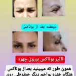 ‏ بهترین کلینیک خدمات ‏لیزر ‏موهای ‏زائد ‏بوتاکس ‏در ‏نازی ‏آباد جنوب تهران