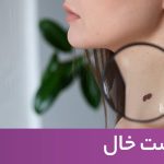 کلینیک زیبایی به آفرین لیزر موهای زاِِئد و تزریق ژل و بوتاکس در سعادت آباد