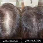 سالن زیبایی شمیم میکروبلیدینگ تاتو خط چشم آرایش دائم در خیابان فرهنگ ساری