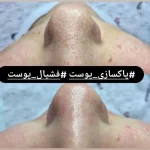 سالن زیبایی شمیم میکروبلیدینگ تاتو خط چشم آرایش دائم در خیابان فرهنگ ساری