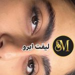 سالن زیبایی مهر مزونیدلینگ ژل لب تزریق بوتاکس در هفت تیر قم