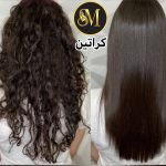 سالن زیبایی مهر مزونیدلینگ ژل لب تزریق بوتاکس در هفت تیر قم