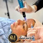 سالن زیبایی مهر مزونیدلینگ ژل لب تزریق بوتاکس در هفت تیر قم