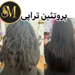 سالن زیبایی مهر مزونیدلینگ ژل لب تزریق بوتاکس در هفت تیر قم