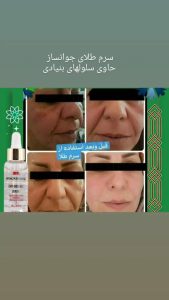 آنلاین ‏شاپ ‏بهار ‏بیوتی ‏جوانساز ‏صورت ‏کرم ‏های ‏مراقبتی ‏ماسک ‏مو ‏در ‏باغستان ‏کرج