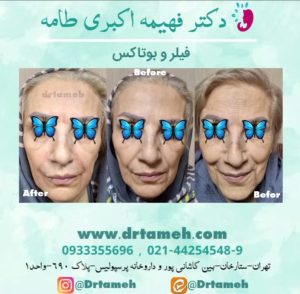 کلینیک زیبایی فهیمه اکبری طامه لاغری موضعی لیزر جوانسازی بوتاکس در تهران ستارخان