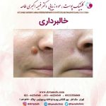 کلینیک زیبایی فهیمه اکبری طامه لاغری موضعی لیزر جوانسازی بوتاکس در تهران ستارخان