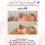 کلینیک زیبایی فهیمه اکبری طامه لاغری موضعی لیزر جوانسازی بوتاکس در تهران ستارخان