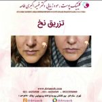 کلینیک زیبایی فهیمه اکبری طامه لاغری موضعی لیزر جوانسازی بوتاکس در تهران ستارخان