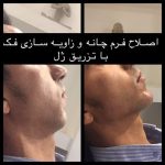 کلینیک ‏دکتر ‏نیلوفر ‏افخمی ‏بوتاکس ‏فیلر ‏هایفو ‏مزوتراپی ‏در ‏مشهد ‏سجاد ‏خیام