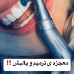 مطب ‏دندانپزشکی ‏پرستیژ ‏خدمات ‏کامپوزیت ‏لمینت ‏و ‏ایمپلنت ‏اقساطی ‏در ‏تهران ‏نازی ‏آباد