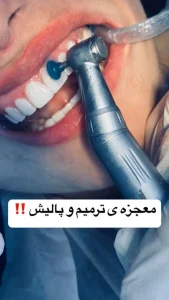 مطب ‏دندانپزشکی ‏پرستیژ ‏خدمات ‏کامپوزیت ‏لمینت ‏و ‏ایمپلنت ‏اقساطی ‏در ‏تهران ‏نازی ‏آباد